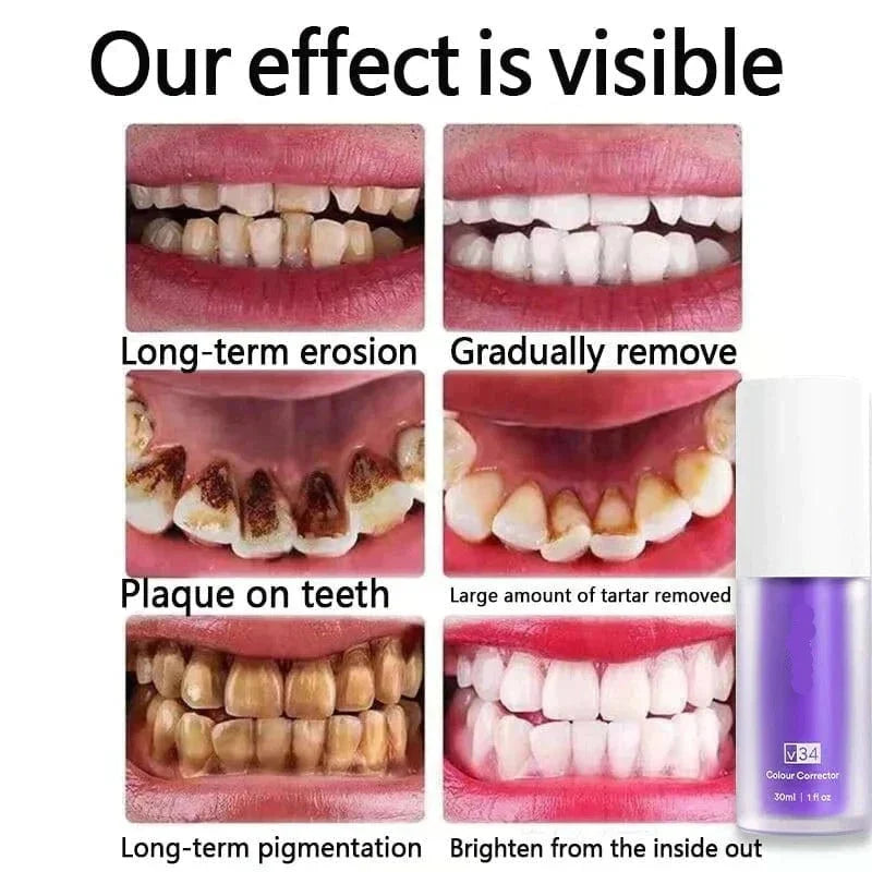 EELHOE® Purple Whitening Toothpaste